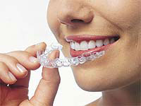 Our Services - Invisalign